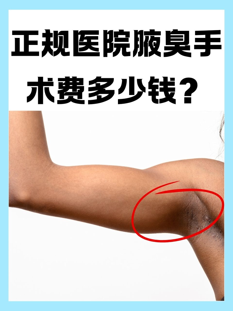 昆明狐臭医院哪家最专业？最新行业动态一览